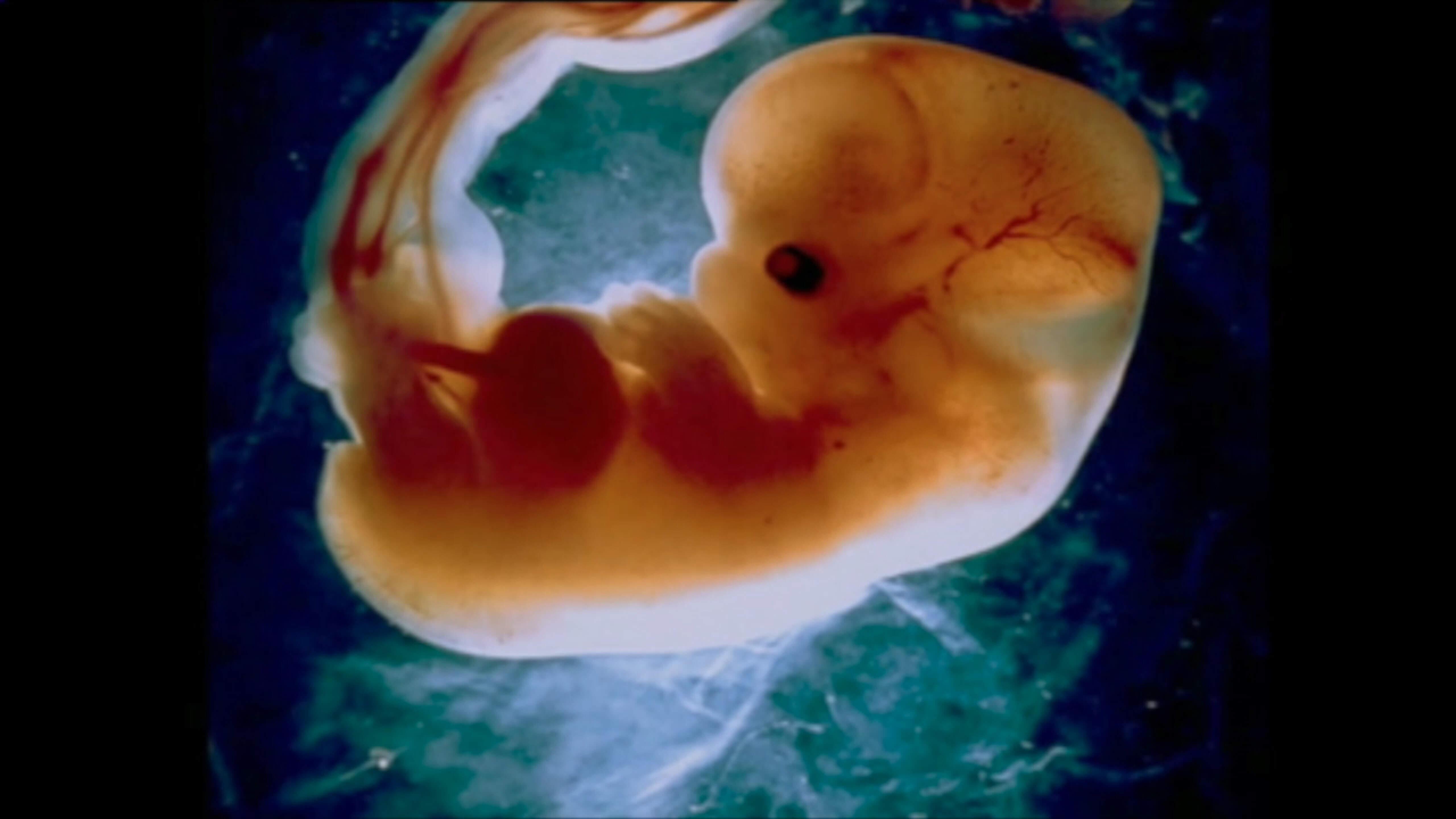 6 недель от зачатия. Зародыш человека 5 недель размер плода. Эмбрион 5-6 недели беременности. Плод на 5 неделе беременности. Зародыш 6 недель размер.