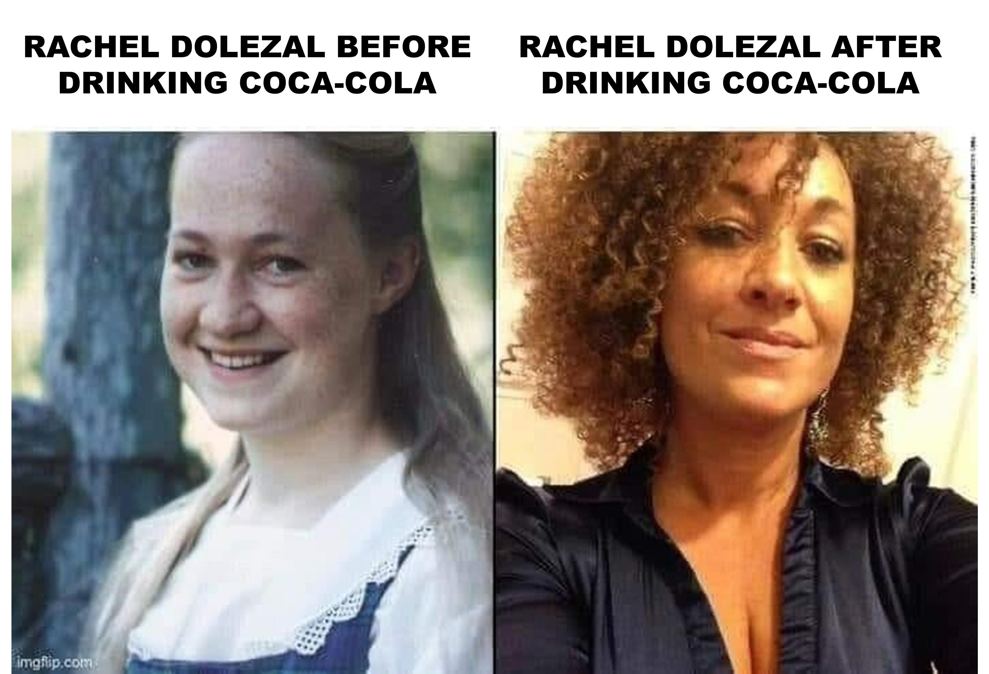 Rachel Dolezal Before And After