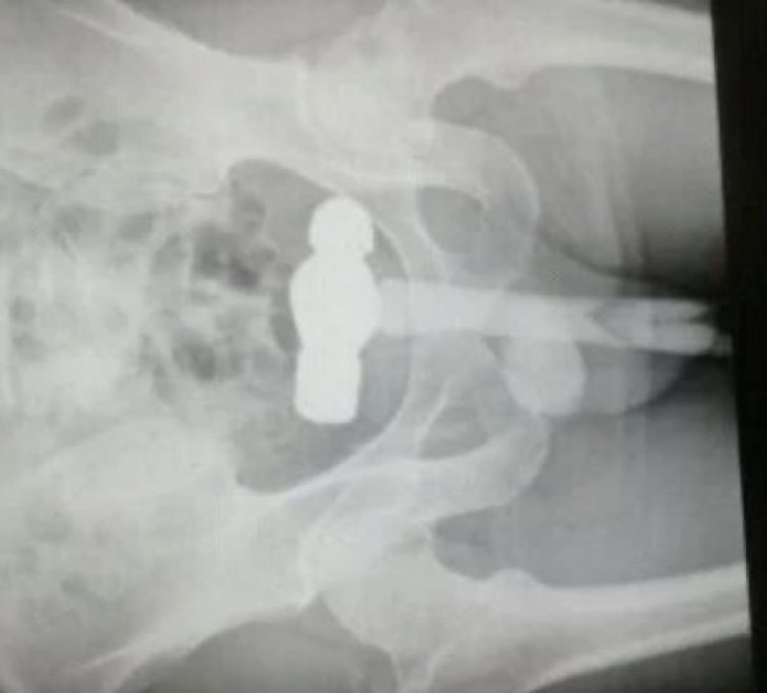 рентген с членом во рту фото 81